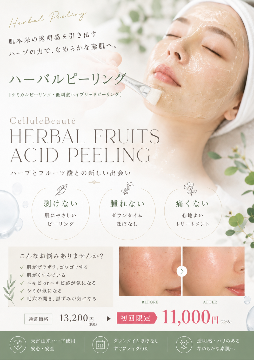 ハーバルピーリング【細胞レベルのエイジングケア・毛穴・凸凹肌改善】