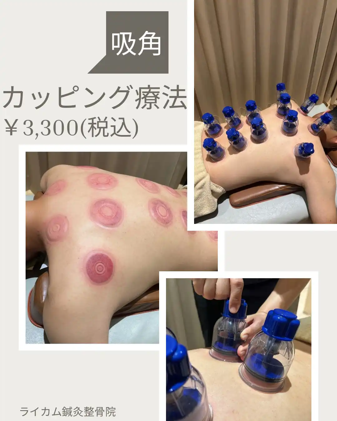 ツライ関節痛や、筋肉のハリに！！