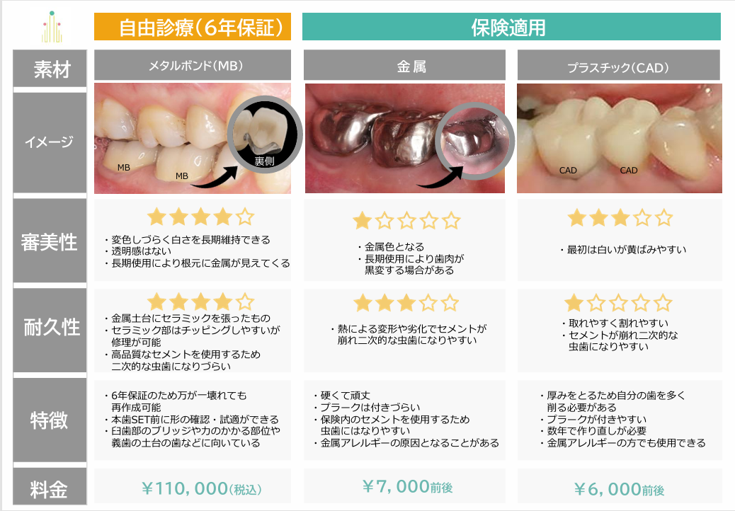 被せものの種類について