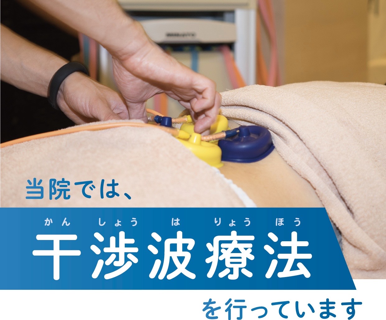 【深部のコリに】じんわり心地よい干渉波で筋肉の緊張緩和