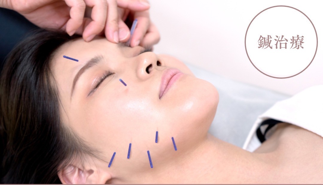 美容鍼で心も外見も元気に！！！！！！！