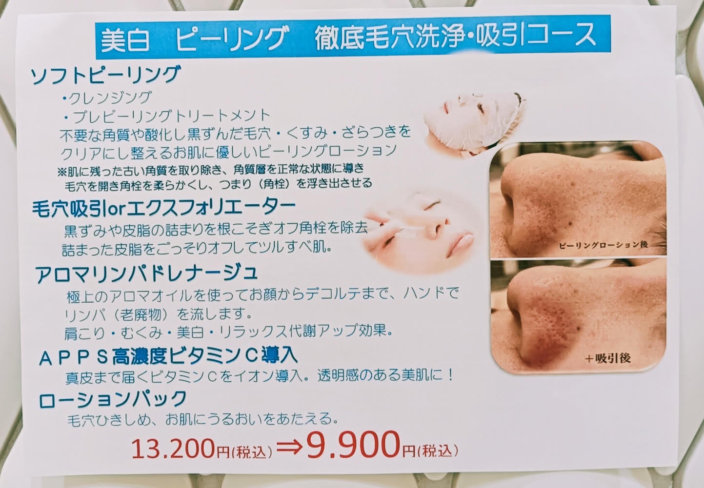 ニュース｜ショップニュース｜6月エステキャンペーン【美白ソフトW